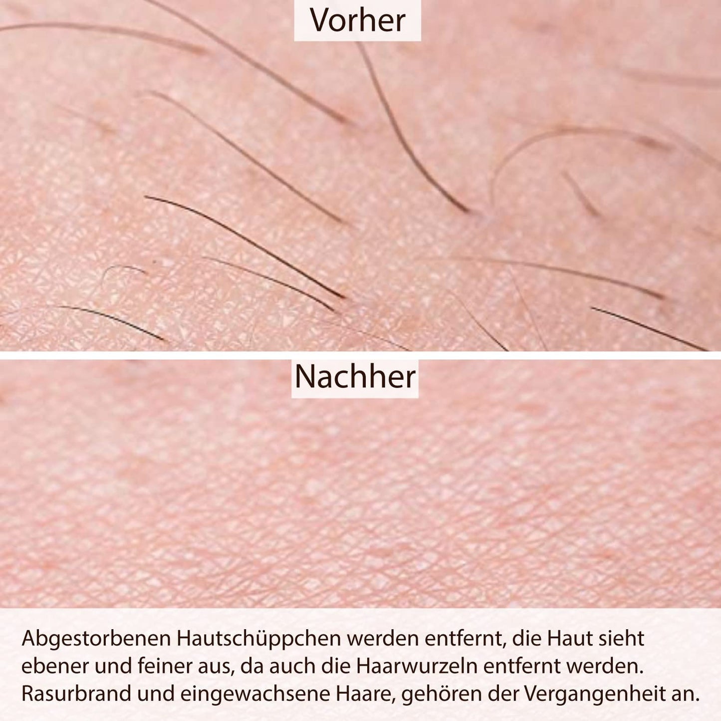 Sugaring-Set mit Zuckerpaste und Vliesstreifen