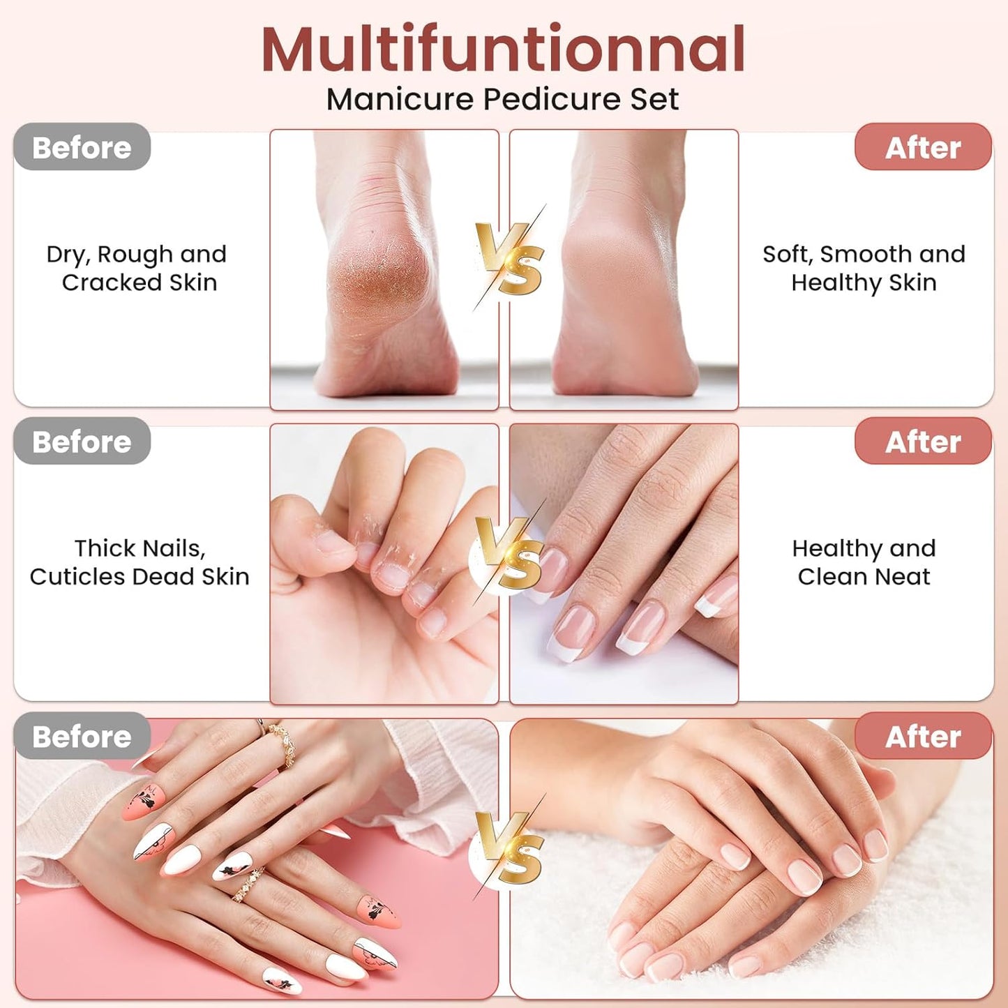 Nagelfräser-Set mit 6 Aufsätzen