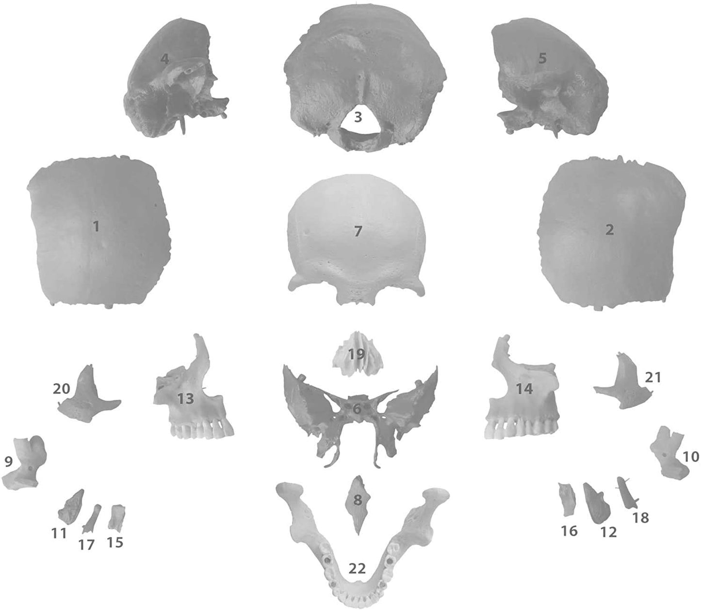 22-teiliges anatomisches Schädelmodell A-217, anatomisch