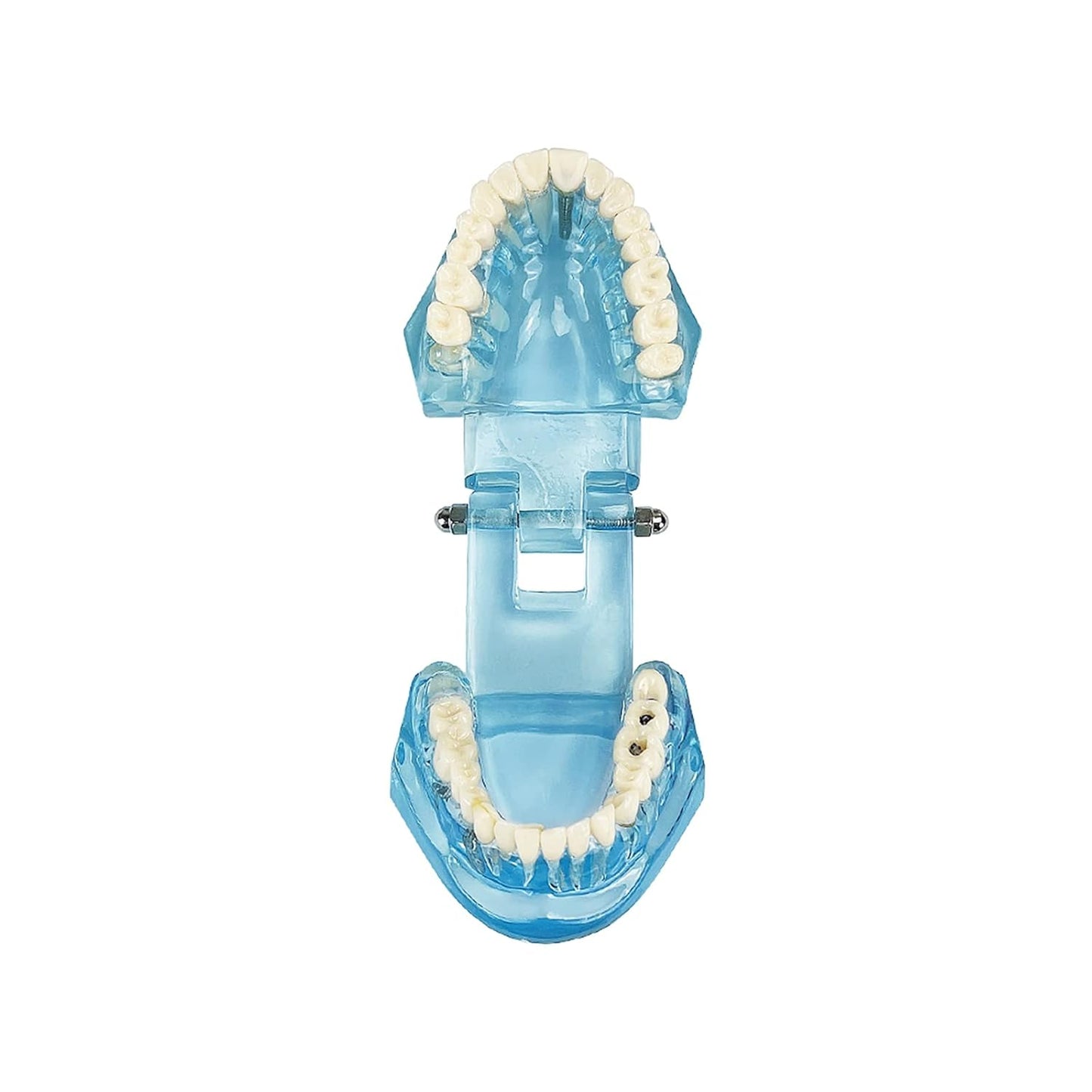 Dental-Modell für Krankheitslehre, entfernbarer Zahn