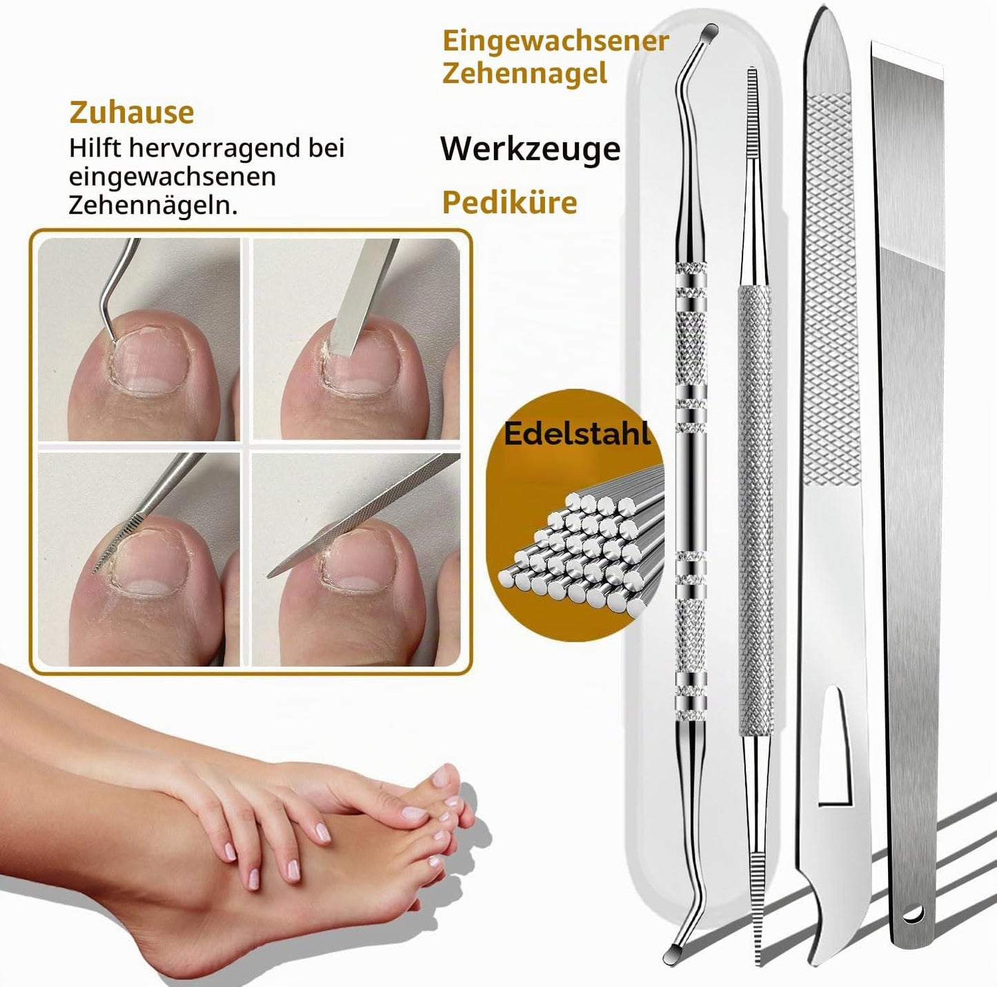 6-teiliges Entfernungsset für eingewachsene Zehennägel, Schwarz