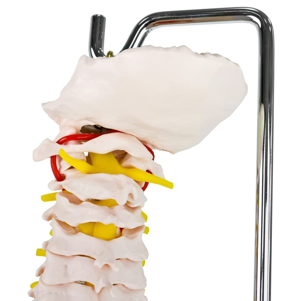 Anatomie Modell Skelett mit Bandscheibenvorfall