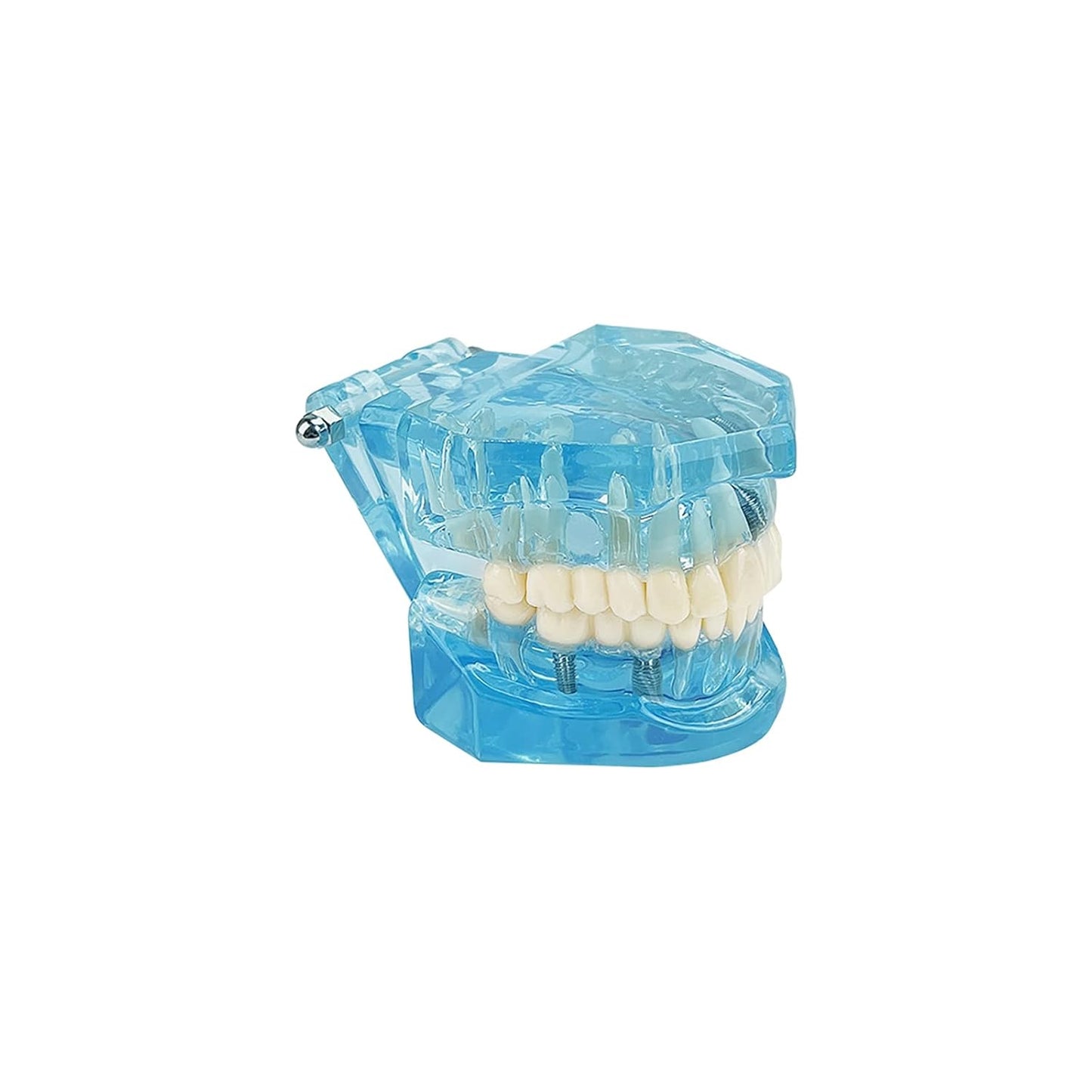 Dental-Modell für Krankheitslehre, entfernbarer Zahn