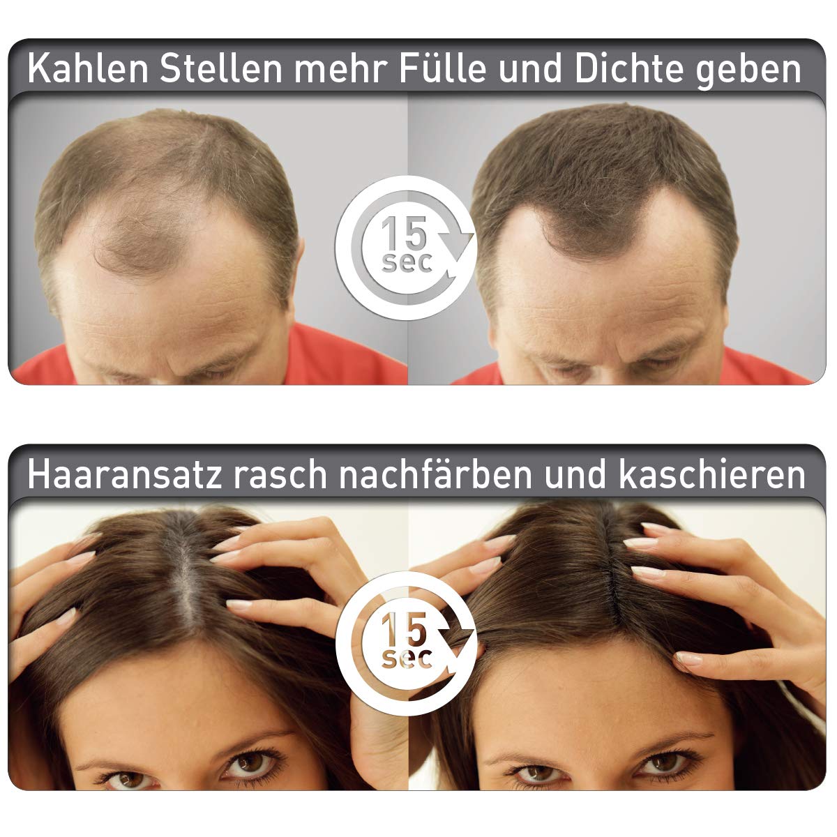 Streuhaar Starter-Set mit Fixierspray, Dunkelbraun