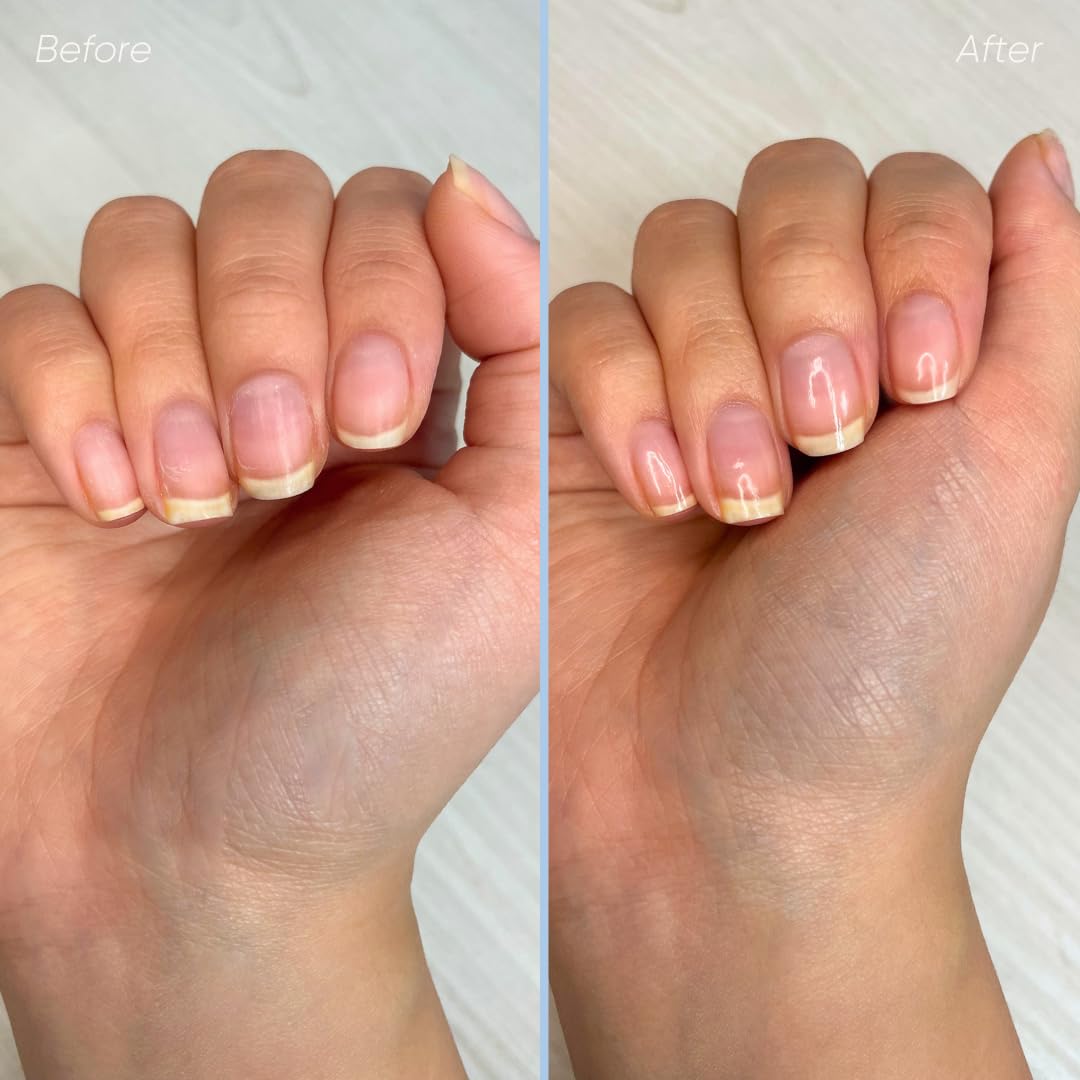 3-in-1 Maniküre Set mit Nagelöl und Rillenfüller, Single