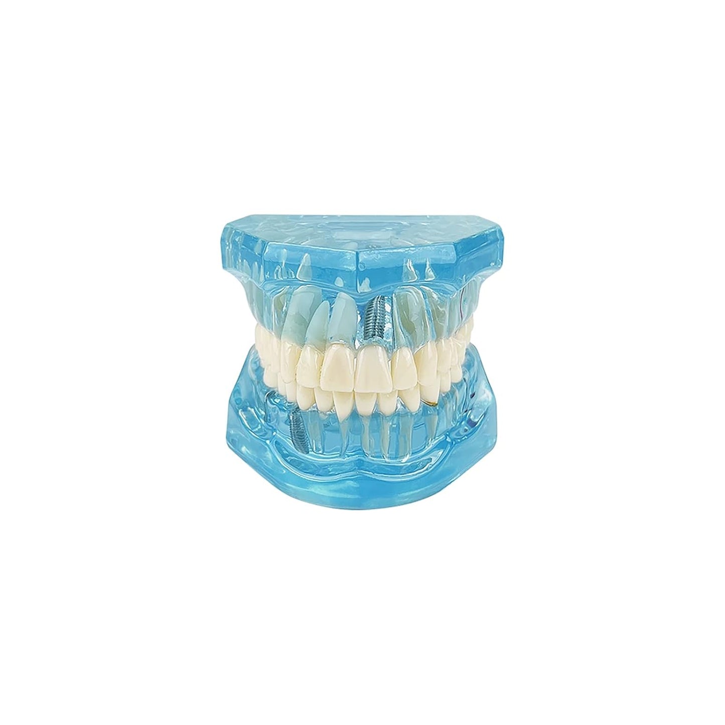 Dental-Modell für Krankheitslehre, entfernbarer Zahn