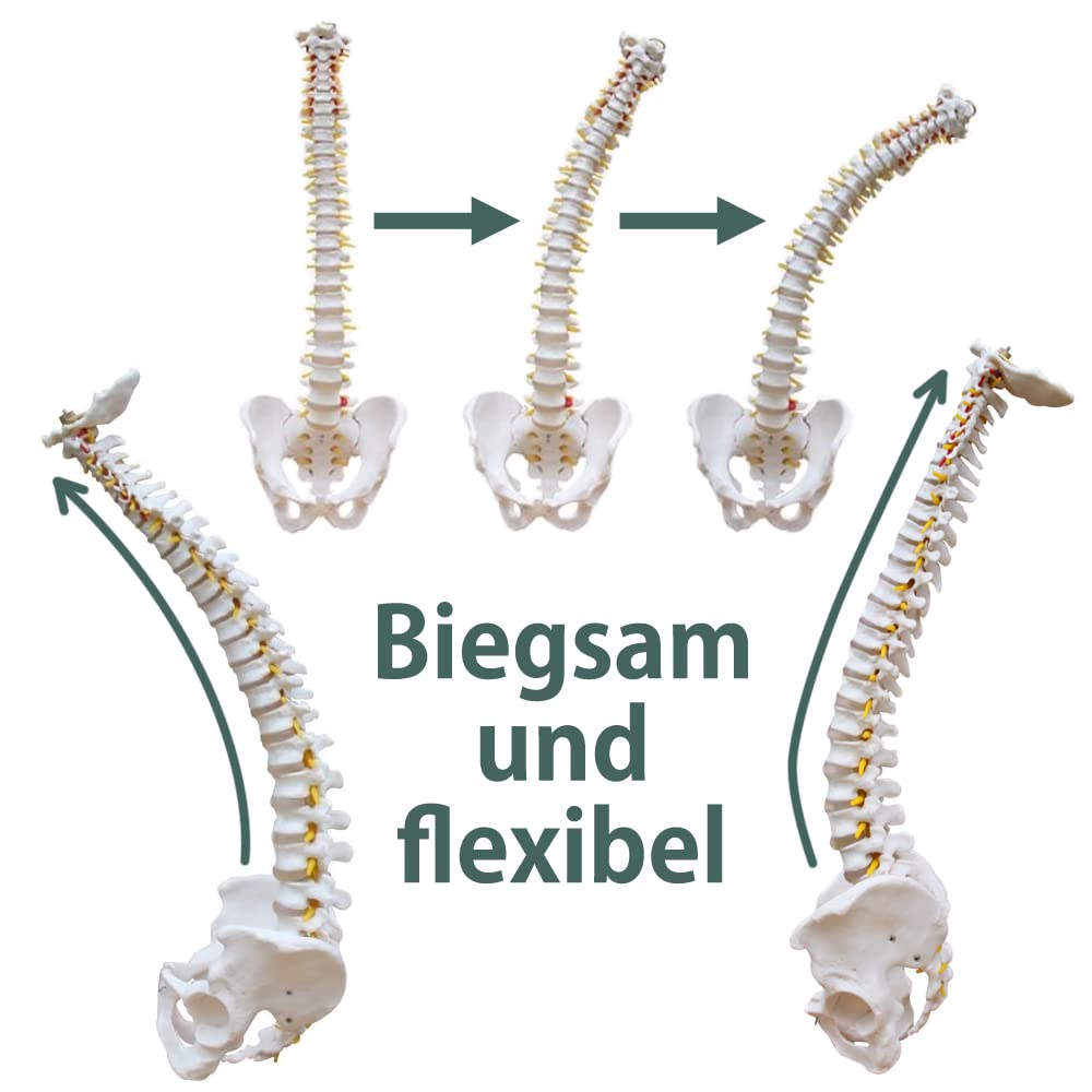 Anatomie Modell Skelett mit Bandscheibenvorfall