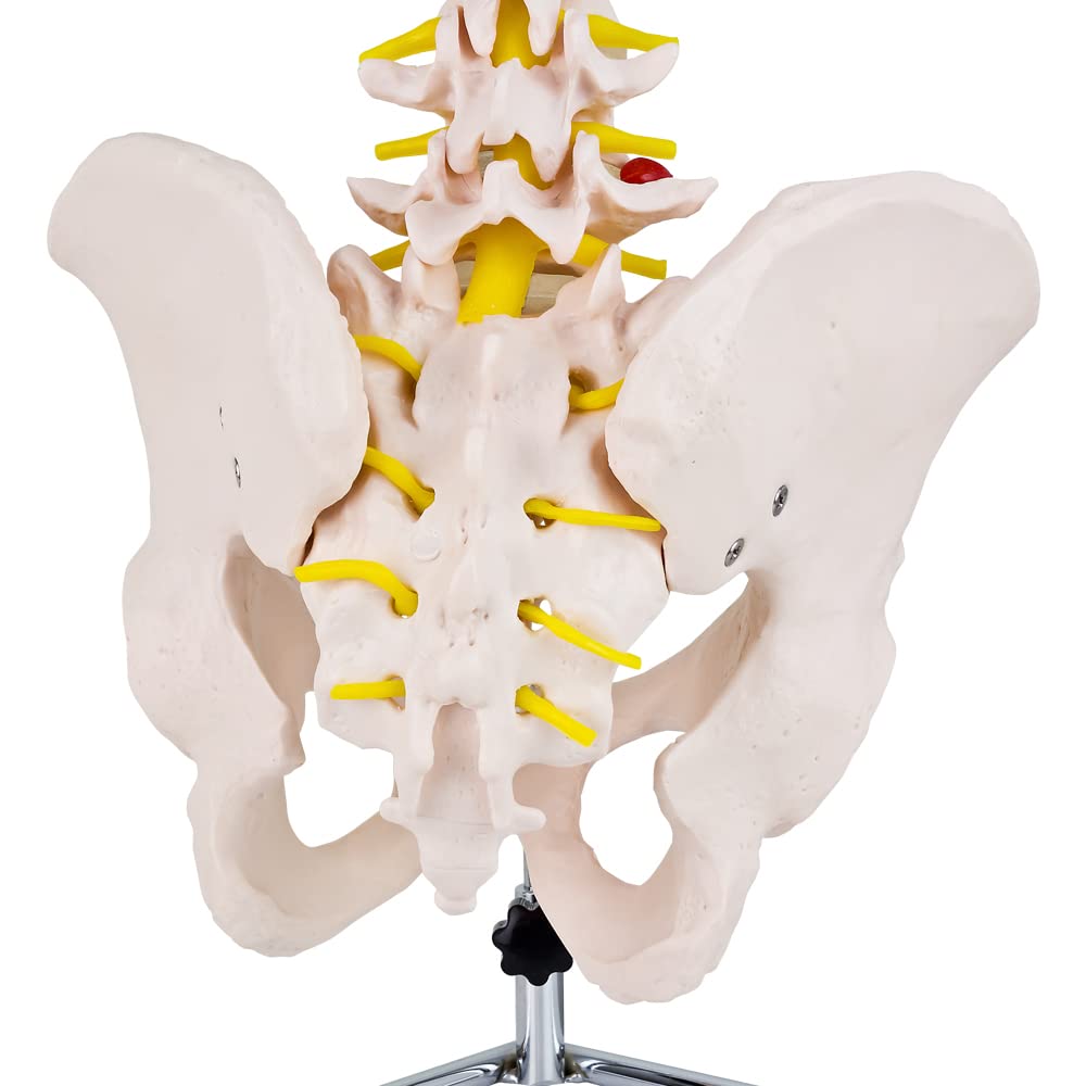 Anatomie Modell Skelett mit Bandscheibenvorfall