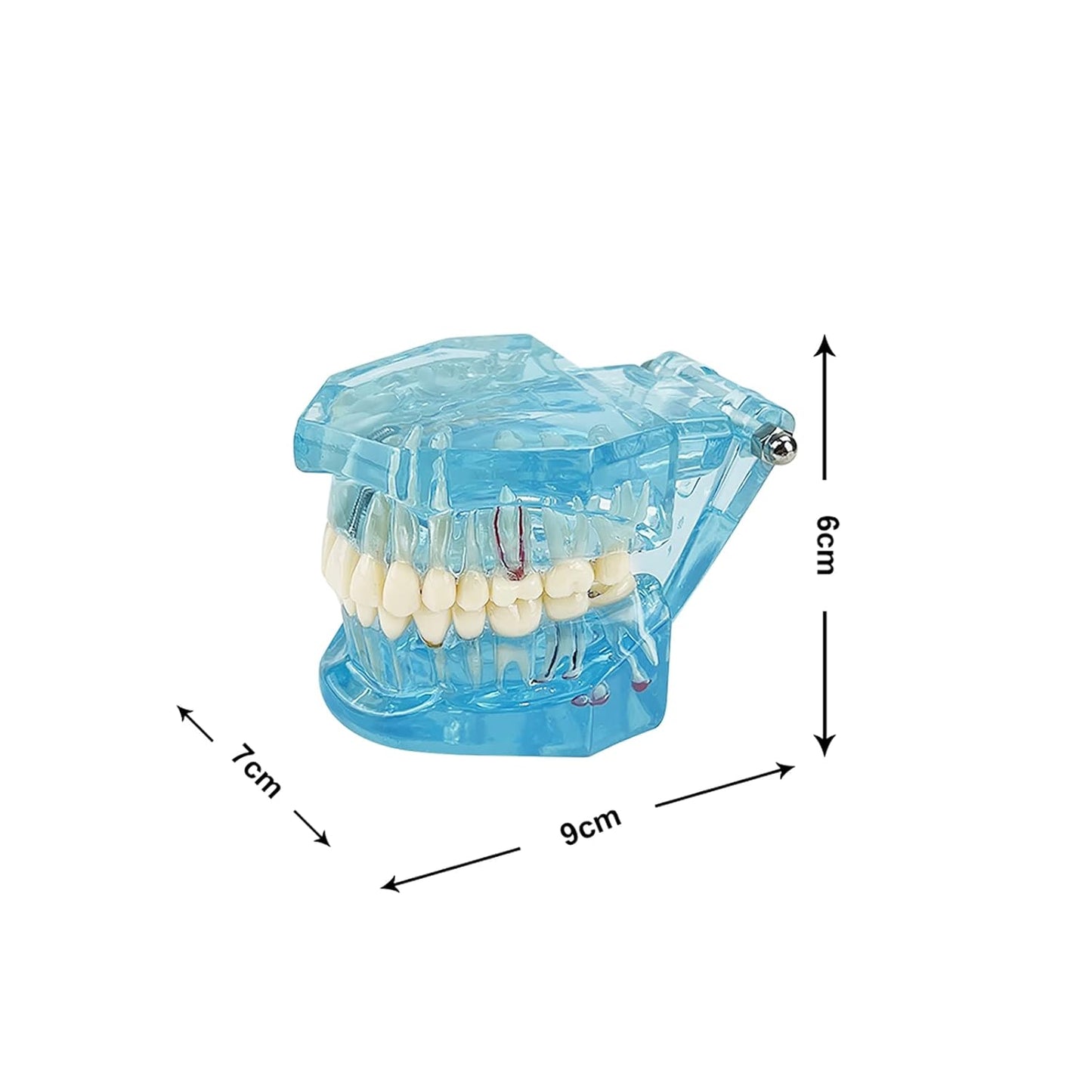 Dental-Modell für Krankheitslehre, entfernbarer Zahn