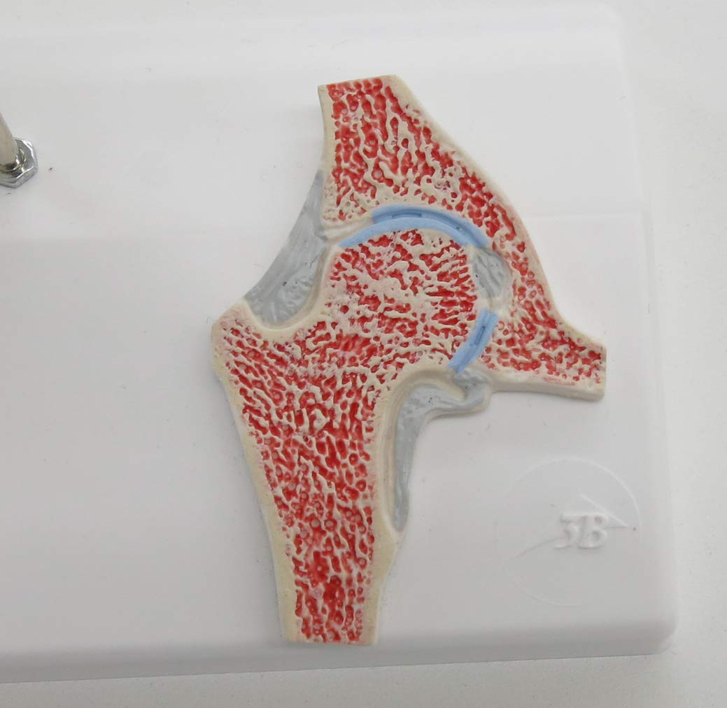 Mini-Hüftgelenk Modell mit Querschnitt, Mini-Hüftgelenk