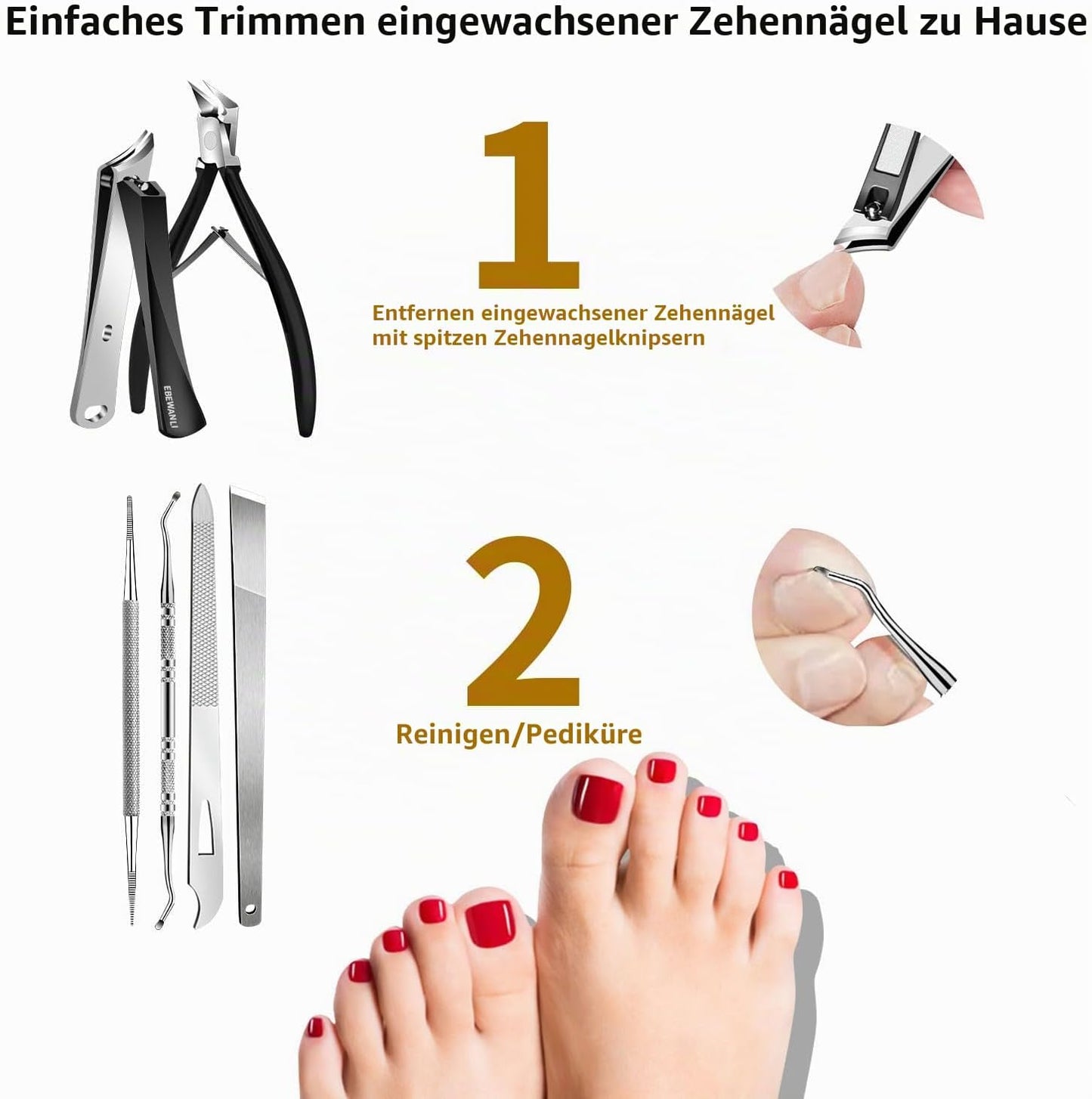 6-teiliges Entfernungsset für eingewachsene Zehennägel, Schwarz