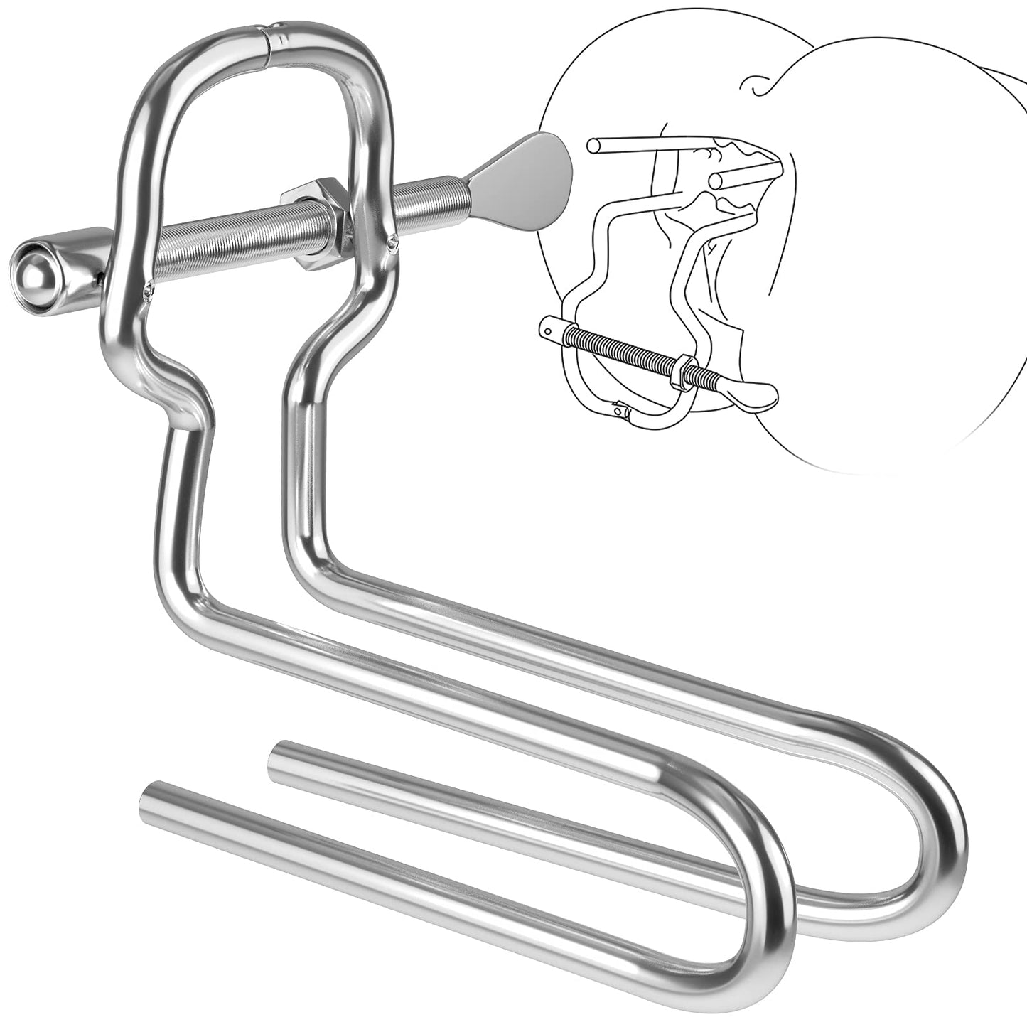 Analexpander